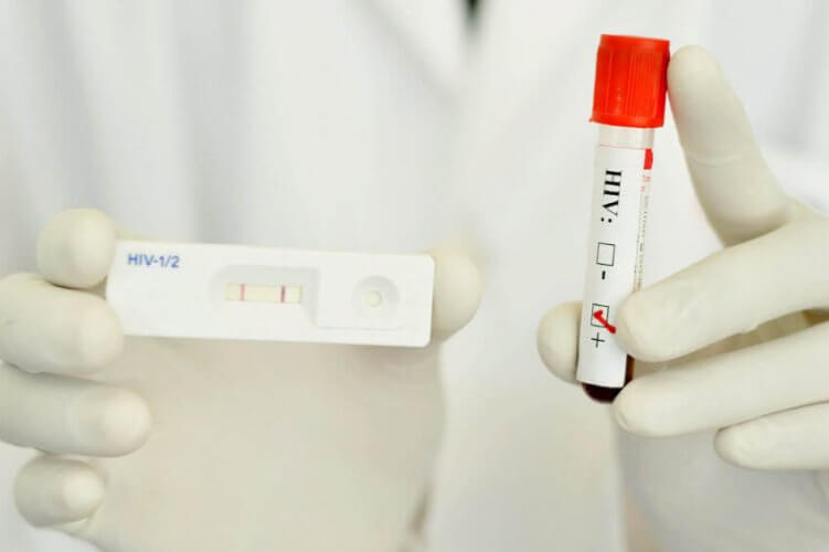 Lab technician's hands in gloves holding an HIV positive test result and the tube with blood sample.